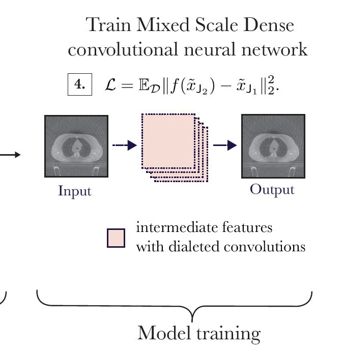 Noise2Aliasing: Unsupervised Deep Learning for Aliasing and Noise Reduction in 4DCBCT